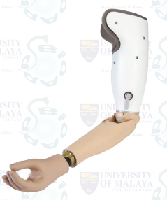 prosthetics-upper limb-myoelectric
